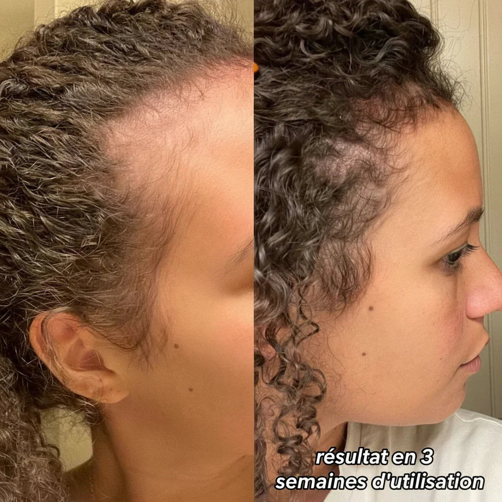 Brosse Massante Réparatrice - Phone&Tech