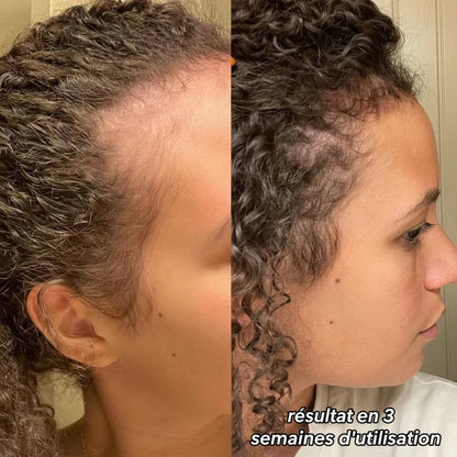 Brosse Massante Réparatrice - Phone&Tech