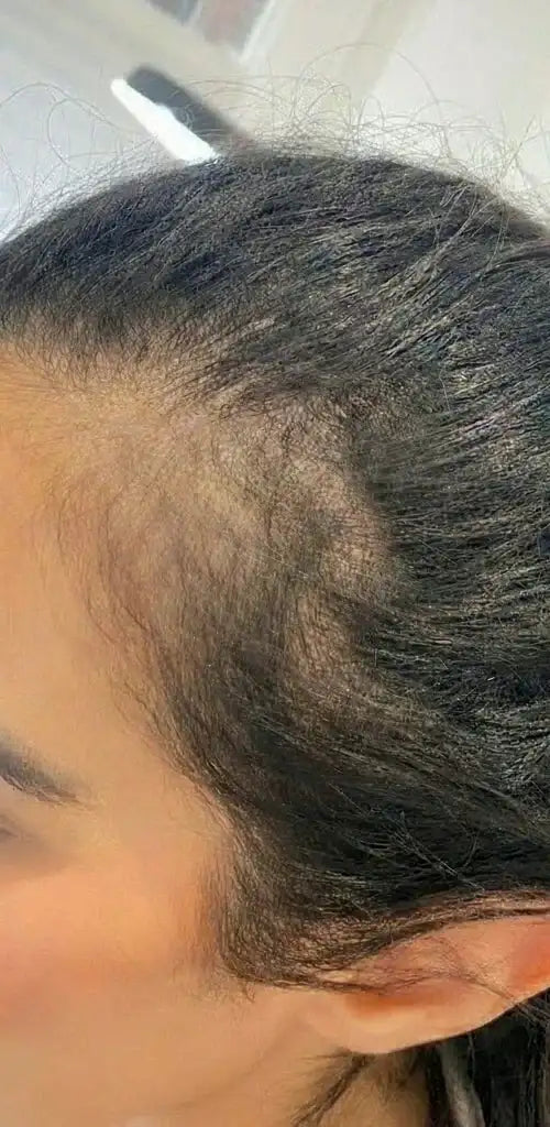 Brosse Massante-Réparatrice de Cure Chevelu