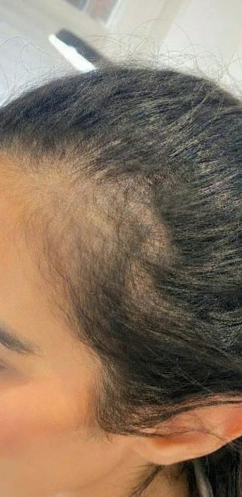 Brosse Massante Réparatrice - Phone&Tech